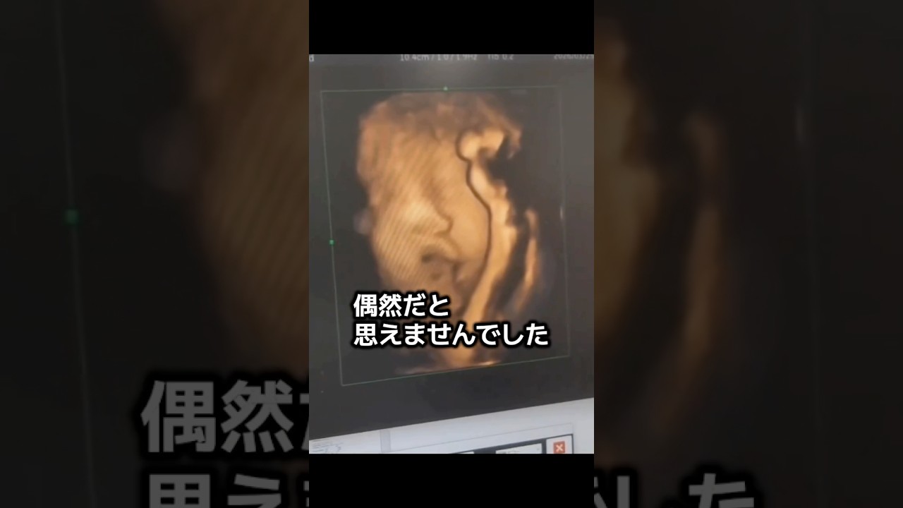 偶然?それとも…?じぃじと重なった瞬間 #赤ちゃん #baby #エコー動画