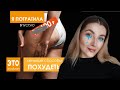 МАССАЖИ ДЛЯ ПОХУДЕНИЯ | Процедуры, которые не работают | Прессотерапия, антицеллюлитный, роликовый