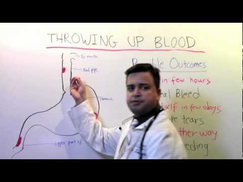 Throwing Up Blood A Video For Patients