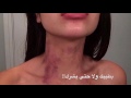 لا صرت متعود