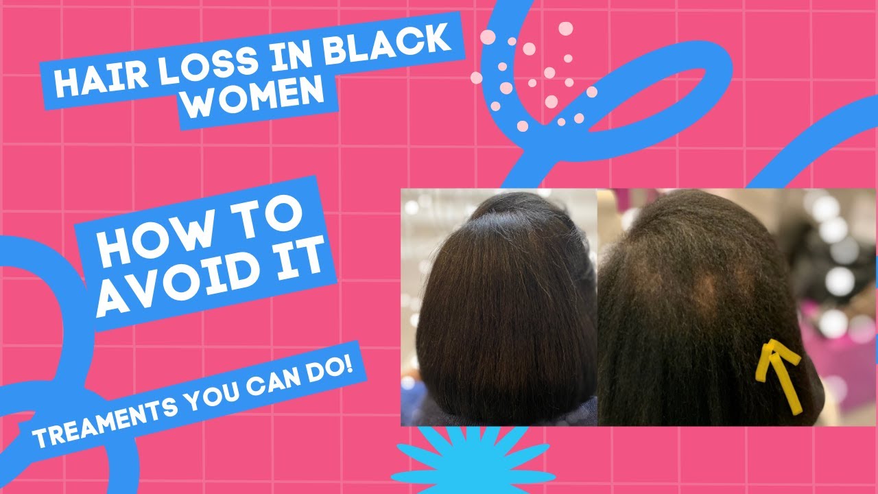 HAIR LOSS IN BLACK WOMEN HOW TO AVOID IT AND TREATMENTS YOU CAN USE TO ...