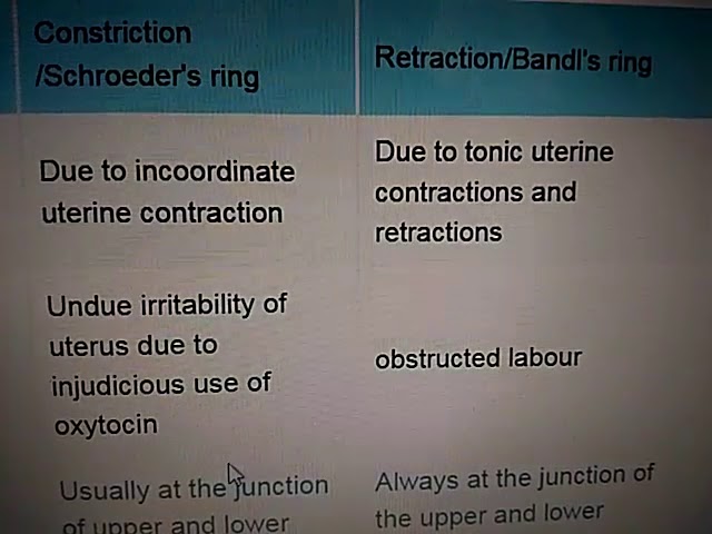 The practice of obstetrics, designed for the use of students and  practitioners of medicine . t uterior even in the same uterus at different  periods. That it undoubtedly existshas been shown by