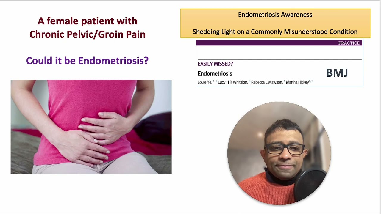 Endometriosis Awareness in a Female Patient with Chronic Pelvic/Groin Pain  