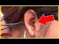 This Conch Piercing Looks BAD!! Removal