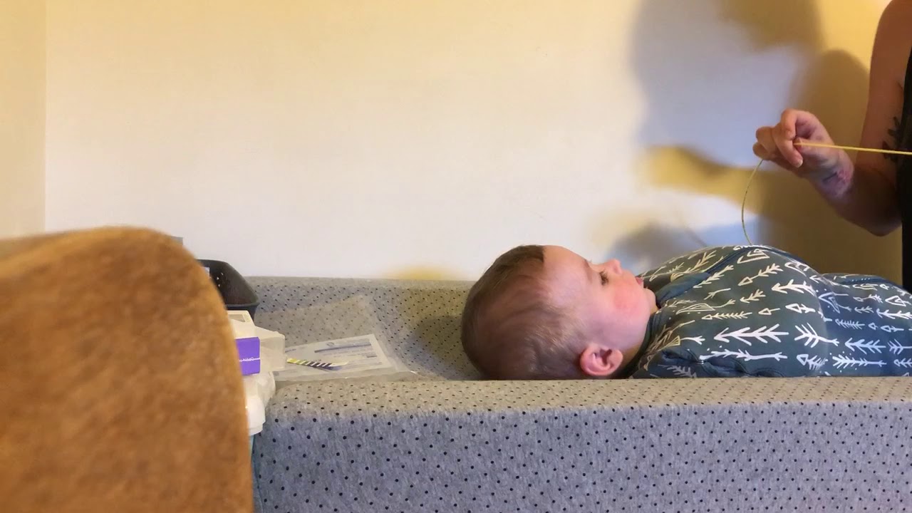 The CDH Mum - Inserting a nasogastric tube for Alfie