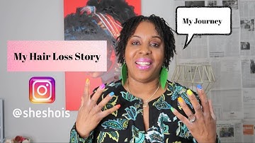 MY HAIR LOSS STORY| ALOPECIA| SISTERLOCKS