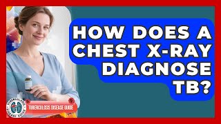How Does A Chest X-ray Diagnose TB? - Tuberculosis Disease Guide