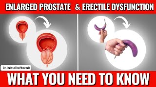 Enlarged Prostate and Erectile Dysfunction: The Facts Every Man Should Know