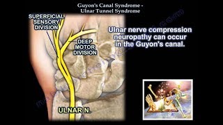 Guyan's Canal Syndrome - Everything You Need To Know - Dr. Nabil Ebraheim