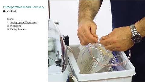 MONTAGEM DA MÁQUINA XTRA LIFETRONIC