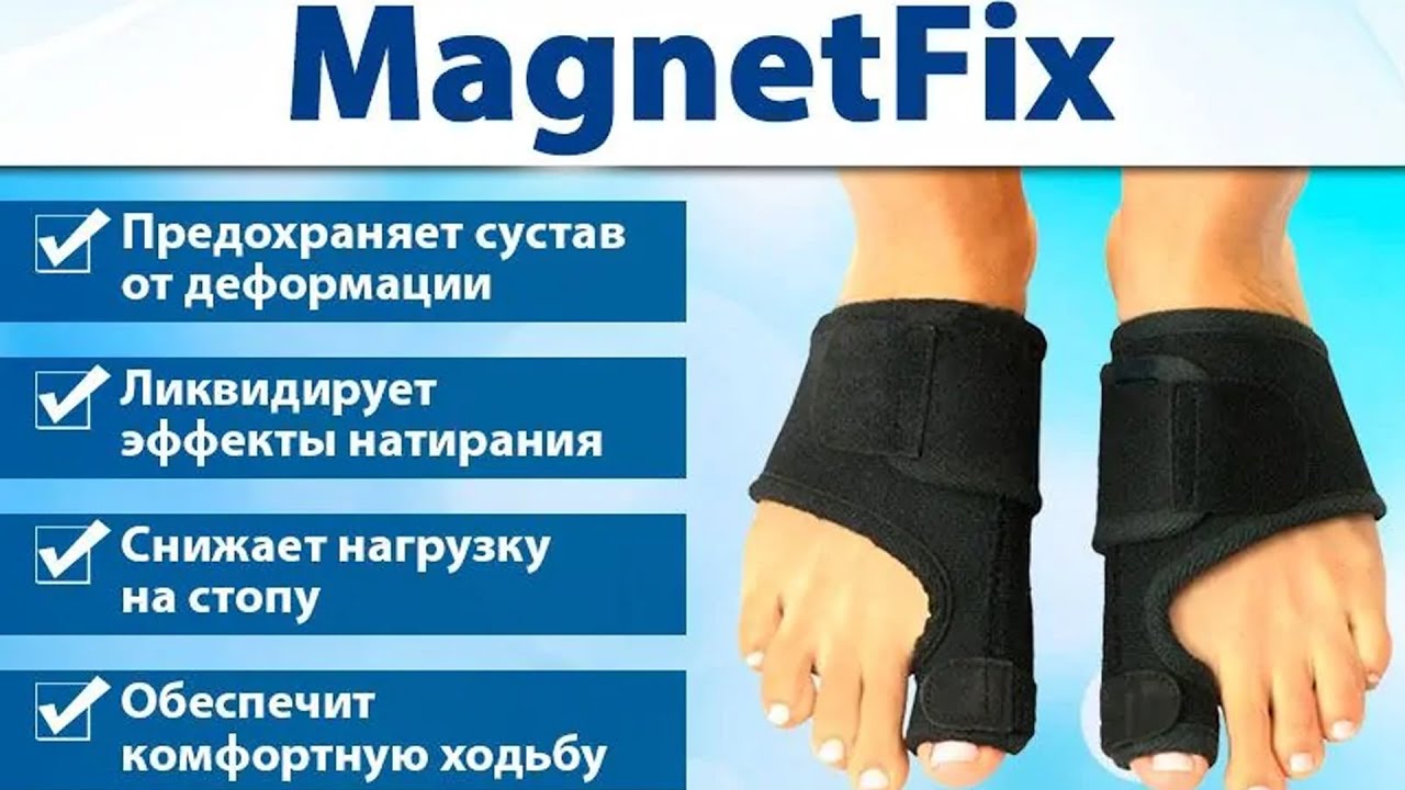 КАК УБРАТЬ ШИШКУ НА БОЛЬШОМ ПАЛЬЦЕ СТОПЫ 💣 ПЛОСКО ВАЛЬГУСНАЯ ДЕФОРМАЦИЯ ...