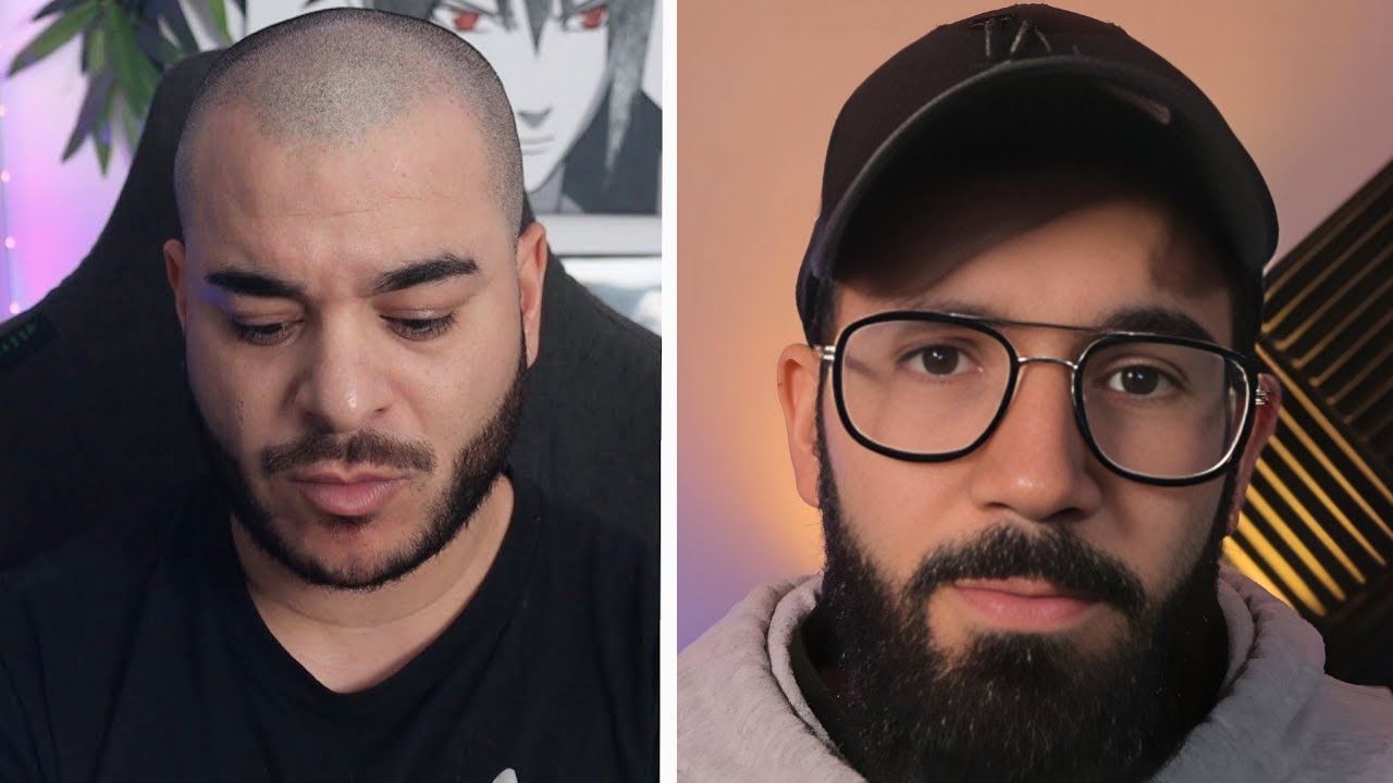 Ma réponse à Riles