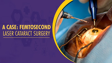 Watch Live Femtosecond Laser-assisted Cataract Surgery performed by Dr. Mahipal