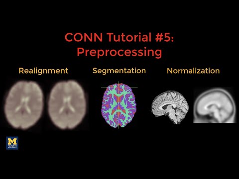 CONN Tutorial #5: Preprocessing