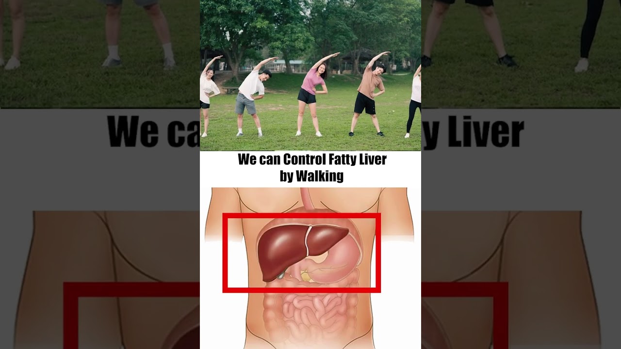 Fatty Liver  A Silent Threat You Can Control! Did you know that Fatty Liver is becoming a major