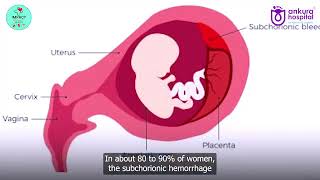 🚨 Bleeding in the 1st Trimester Don’t Panic — But Don’t Ignore It Either!