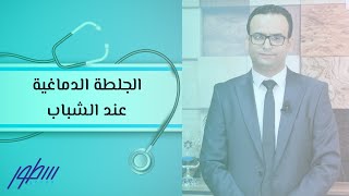 أعراض الجلطة الدماغية عند الشباب