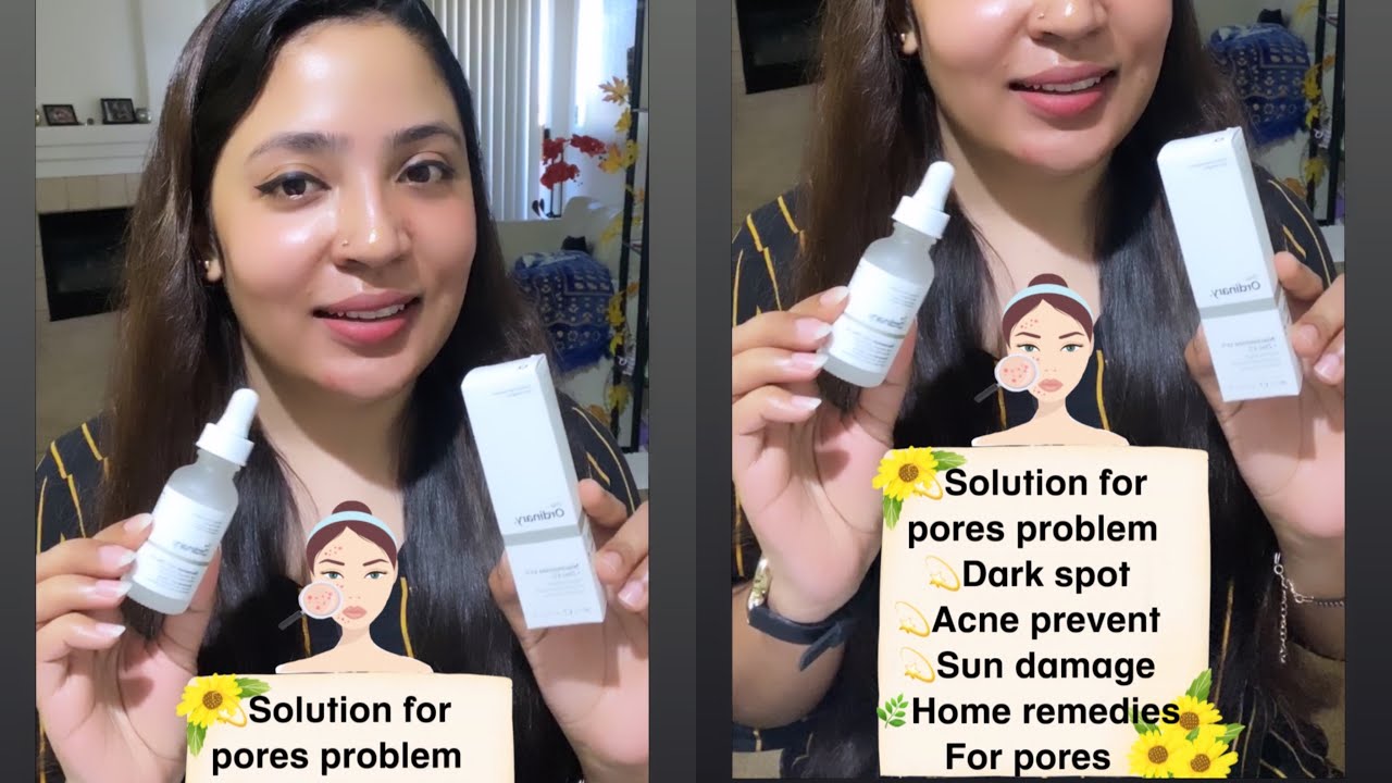 Solution For Dark Spot And Pores Problem Home Remedies For Pores solution-for-dark-spot-and-pores-problem-home-remedies-for-pores