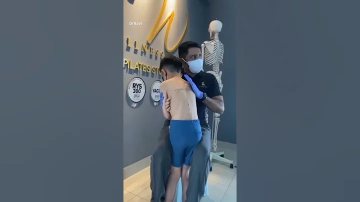 #scoliosis #kyphosis #treatment #spine #india #malaysia #singapore #maldives #world