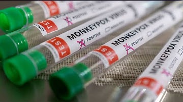 Scores Of Monkeypox Cases Reported In Non-Endemic Countries