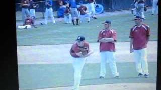 Celebrity pitcher breaks arm Profile