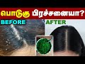         dandruff treatment at home  men  women