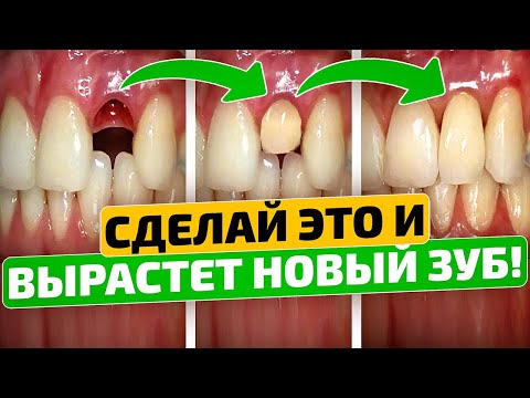 Старый зубник: Нам запретили про такое рассказывать! Как вырастить новые зубы в любом возрасте