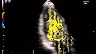 A70 Vector Flow Mapping