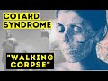 Cotard syndrome  walking corpse syndrome  what is it short documentary