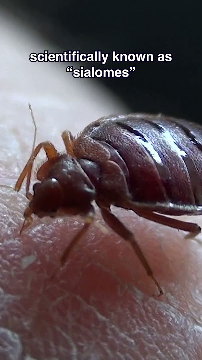 Can Bed Bugs Bite Without You Knowing?