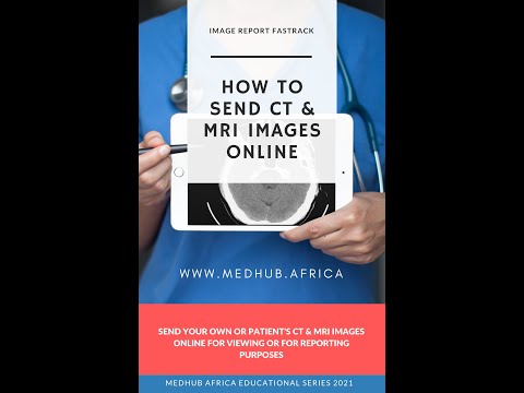How to send a CT or MRI image on a CD Plate Online for reporting or second opinion.
