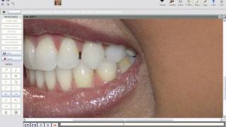 SNAP Dental Simulation Software screenshot 5