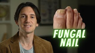 Fungal Nail / Onychomycosis