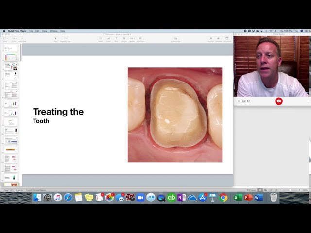 Tooth Preparation Prior To Seating A Restoration - YouTube