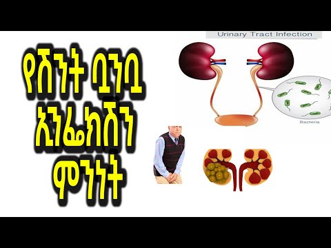 ቪዲዮ: ፊኛ መጫወቻ እንዴት እንደሚሠራ