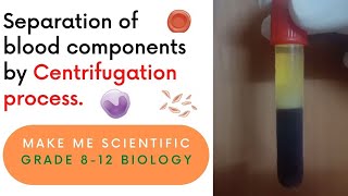 Separation of Human Blood Components by Centrifugation Process | Grade 8-12 | Biology Demo