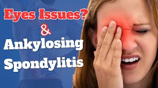 How is Ankylosing Spondylitis Affecting the Eyes? screenshot 3