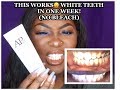 HOW TO GET WHITER TEETH IN A WEEK - NO BLEACH! l GLOW UP 2k19