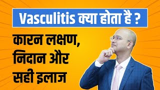 What is Vasculitis | Symptoms and Treatment of Vasculitis | Dr Sushant Shinde