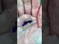 Small Fish Brings A Huge Surprise