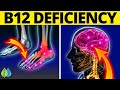 ⚠️Top 11 Vitamin B12 Deficiency Symptoms You Need to Know