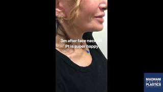 Surgery Post Op Compilation Video 2
