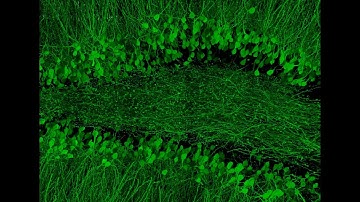 Mouse Hippocampus in 3D