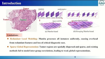 [ICCV Oral] GMMamba_ Group Masking Mamba for Whole Slide Image Classification