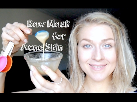 Raw Face Mask for Acne: Honey, ACV, Baking Soda & Glowing Skin