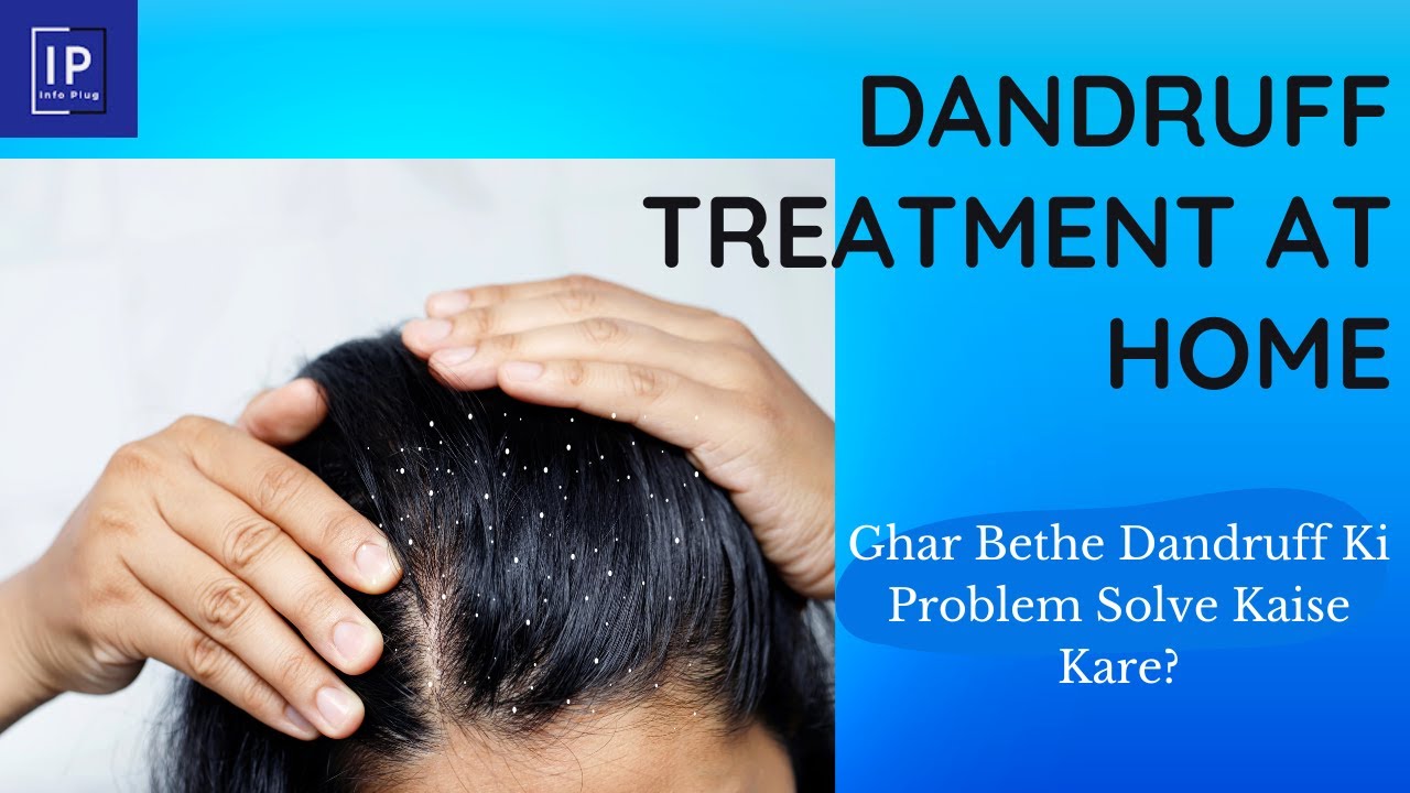 Dandruff Treatment at Home Dandruff Kaise Hataye Dandruff Removal