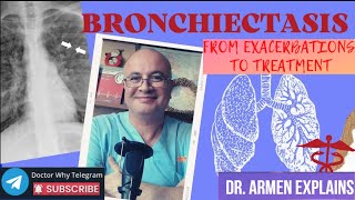 Bronchiectasis - 2. From Exacerbations to Treatment