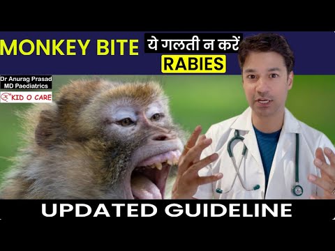 Monkey Bite Rabies Update: Observation Period and Anti Rabies Vaccine with HRIG by Dr Anurag Prasad