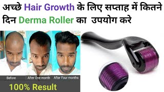 How many days in a week to use derma roller for good hair growth || How to use derma roller properly