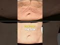 Non-invasive body contouring has evolved beyond just fat reduction | #evolvex